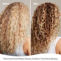 DANDRUFF CONDITIONER